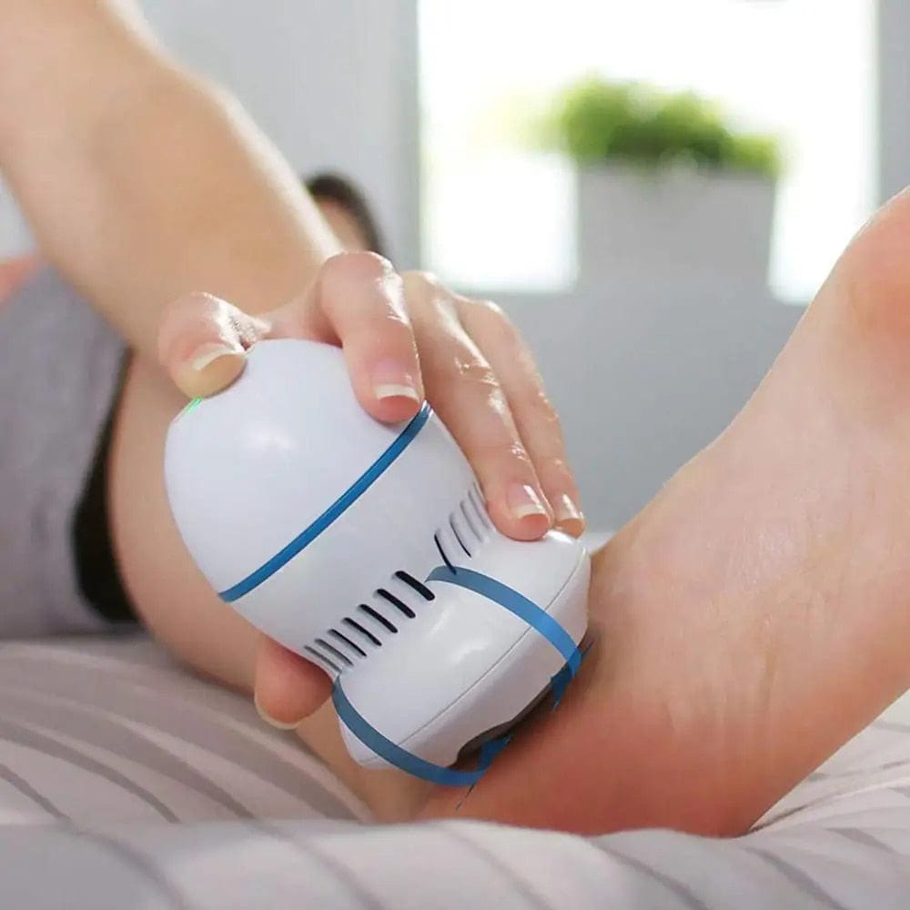 SoftFeet - Rimuovi Calli