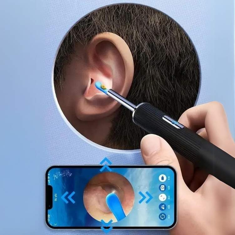 ClearView Pulisciorecchie – Intelligente, Sicuro e Igienico