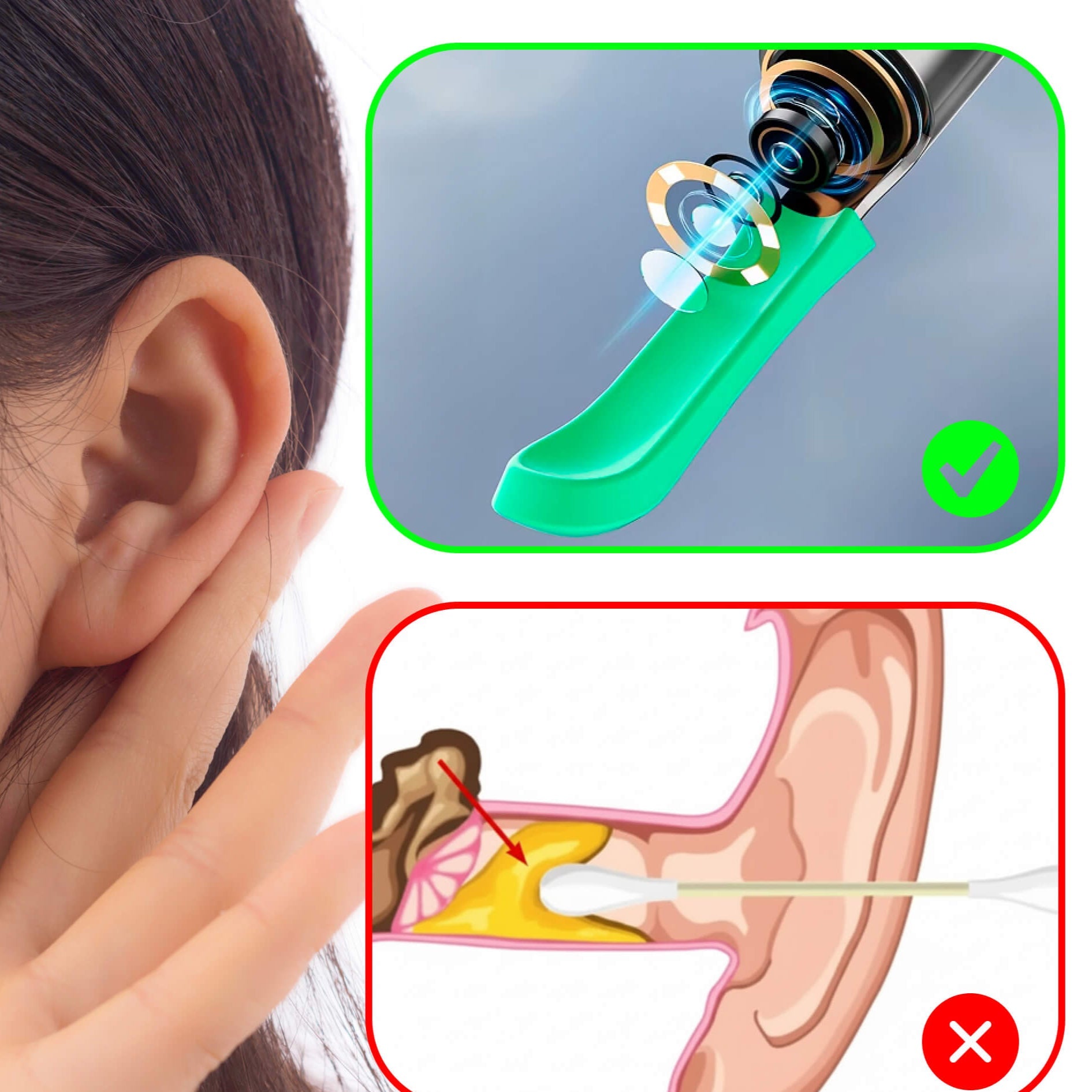 ClearView Pulisciorecchie – Intelligente, Sicuro e Igienico